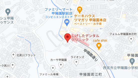 評判の良い近くの矯正歯科なら - 西宮矯正歯科相談室（西宮・西宮市・甲陽園）