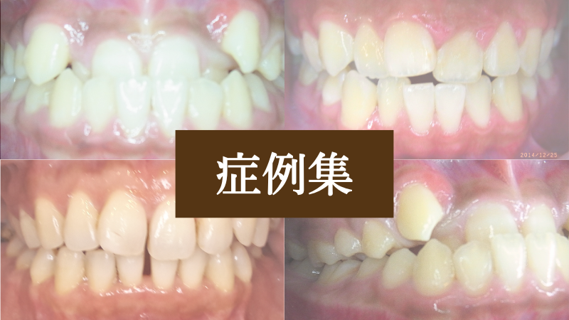 症例集